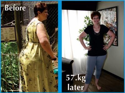 Jeannette-tlc-weightloss-medicaldiet-portelizabeth